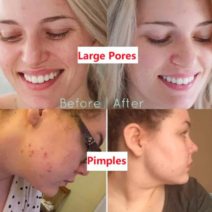 Green Tea Deep Cleanse Mask – Pore Detox & Glow