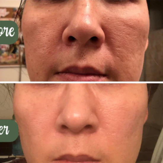 Green Tea Deep Cleanse Mask – Pore Detox & Glow