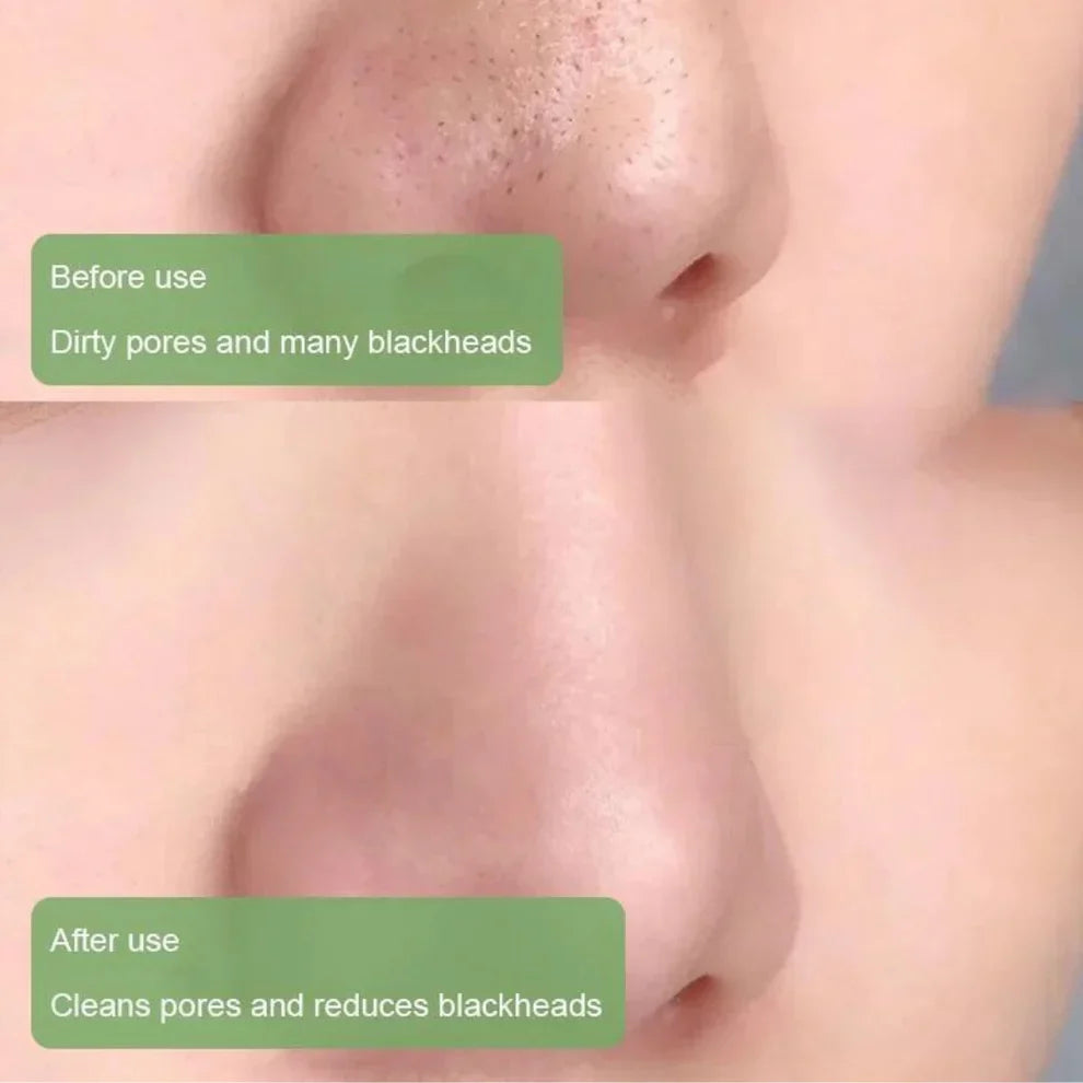 Green Tea Deep Cleanse Mask – Pore Detox & Glow